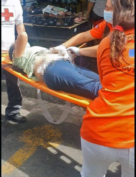 Mujer es herida al ser asaltada en baños del Mercado #1 de Santa Ana, El Salvador.